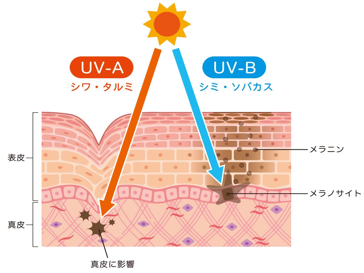 紫外線（UVB）が引き起こすターンオーバーの乱れ